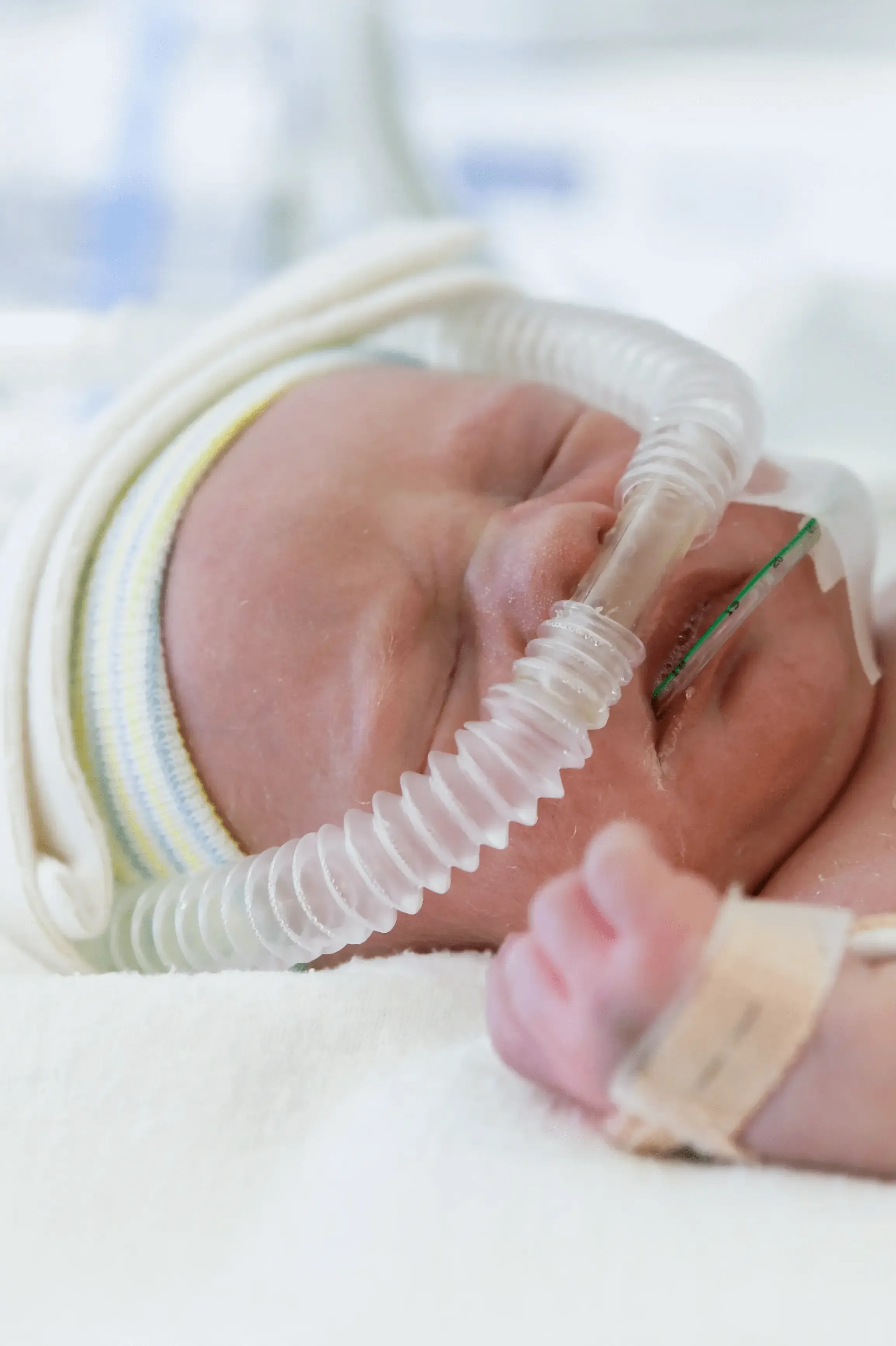 Curso de Assistência Ventilatória Mecânica na Neonatologia